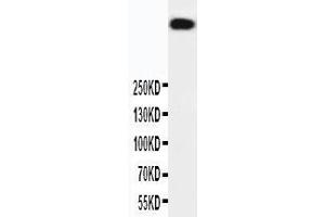 Western Blotting (WB) image for anti-Protein Kinase, DNA-Activated, Catalytic Polypeptide (PRKDC) (AA 328-346), (N-Term) antibody (ABIN3042975)