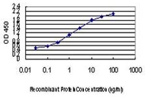 Detection limit for recombinant GST tagged ZIC4 is approximately 0. (ZIC4 抗体  (AA 249-319))