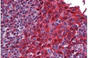 Human Tonsil: Formalin-Fixed, Paraffin-Embedded (FFPE) (SMN1 抗体  (AA 45-94))