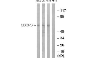 Western Blotting (WB) image for anti-ATP/GTP Binding Protein-Like 4 (AGBL4) (C-Term) antibody (ABIN1851213) (AGBL4 抗体  (C-Term))
