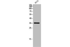 Western Blot analysis of PC12 cells using CD298 Polyclonal Antibody (ATP1B3 抗体  (C-Term))