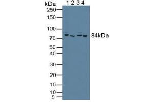 Figure. (PFKP 抗体  (AA 553-753))