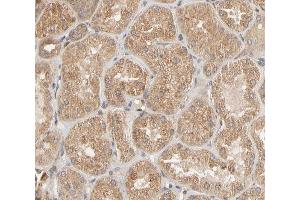 Immunohistochemistry (IHC) image for anti-zeta-Chain (TCR) Associated Protein Kinase 70kDa (ZAP70) (pTyr493) antibody (ABIN6256749)