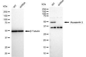 Western blotting analysis using Aquaporin 1 antibody (ABIN7797637).