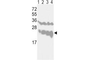 Western Blotting (WB) image for anti-Ubiquitin Carboxyl-terminal Esterase L1 (Ubiquitin Thiolesterase) (UCHL1) (AA 16-46) antibody (ABIN3029423)
