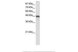 Image no. 1 for anti-RNA Binding Motif, Single Stranded Interacting Protein 3 (RBMS3) (AA 125-174) antibody (ABIN203122) (RBMS3 抗体  (AA 125-174))