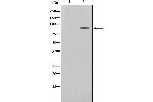 Western blot analysis on HeLa cell lysate using ES8L2 Antibody,The lane on the left is treated with the antigen-specific peptide.