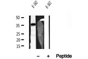 Western blot analysis of extracts of K-562 cells, using JTV1 antibody. (AIMP2 抗体  (Internal Region))