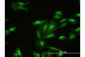 Immunofluorescence of monoclonal antibody to FHL2 on HeLa cell. (FHL2 抗体  (AA 1-279))