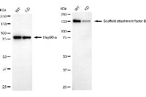 Western blotting analysis using scaffold attachment factor B antibody (ABIN7800275). (Recombinant SAFB 抗体)