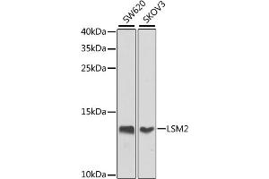 Western blot analysis of extracts of various cell lines, using LSM2 antibody (ABIN6131870, ABIN6143358, ABIN6143359 and ABIN6224004) at 1:1000 dilution. (LSM2 抗体  (AA 1-95))