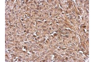 IHC-P Image Immunohistochemical analysis of paraffin-embedded RT2 xenograft, using TrxR1, antibody at 1:500 dilution. (TXNRD1 抗体)