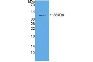 Detection of Recombinant EIF3A, Mouse using Polyclonal Antibody to Eukaryotic Translation Initiation Factor 3A (EIF3A) (EIF6 抗体  (AA 622-848))