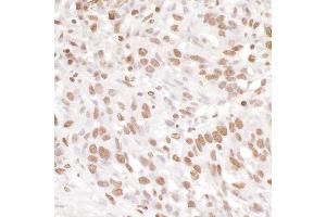 Immunohistochemistry (IHC) image for anti-Ewing Sarcoma Breakpoint Region 1 (EWSR1) (AA 100-150) antibody (ABIN7453905)