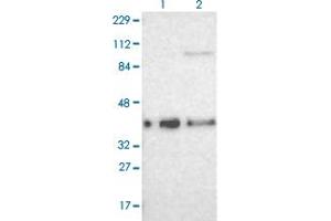 Western blot analysis of Lane 1: Human cell line RT-4 Lane 2: Human cell line U-251MG sp with CDKN1C polyclonal antibody  at 1:100-1:250 dilution. (CDKN1C 抗体)