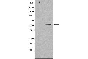 Western blot analysis of extracts from HuvEc cells, using SHB antibody. (SHB 抗体  (C-Term))