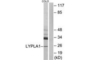 Western blot analysis of extracts from COLO cells, using LYPLA1 Antibody. (LYPLA1 抗体  (AA 51-100))