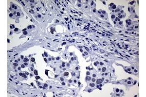 Image no. 1 for anti-Nibrin (NBN) (AA 183-460) antibody (ABIN1491067) (Nibrin 抗体  (AA 183-460))