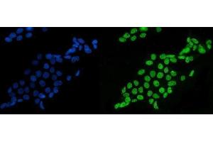 IF analysis of splicing factor 1 using anti-splicing factor 1 antibody (ABIN7600194).