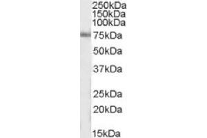 Image no. 1 for anti-Inositol-Trisphosphate 3-Kinase C (ITPKC) (Internal Region) antibody (ABIN375071) (ITPKC 抗体  (Internal Region))