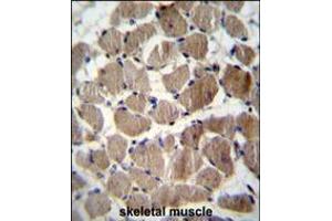 COCH Antibody immunohistochemistry analysis in formalin fixed and paraffin embedded human skeletal muscle followed by peroxidase conjugation of the secondary antibody and DAB staining. (COCH 抗体  (AA 399-428))