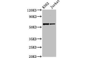 Western Blot Positive WB detected in: K562 whole cell lysate, Jurkat whole cell lysate All lanes: NAMPT antibody at 2. (NAMPT 抗体  (AA 1-280))