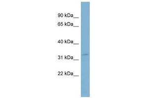 SLC25A20 antibody used at 1 ug/ml to detect target protein.