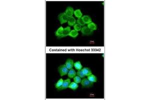 ICC/IF Image Immunofluorescence analysis of methanol-fixed A431, using AGAP3, antibody at 1:200 dilution. (AGAP3 抗体  (C-Term))
