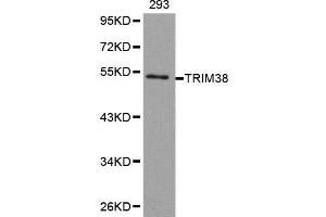 Western blot analysis of extracts of 293 cell line, using TRIM38 antibody. (TRIM38 抗体  (AA 266-465))
