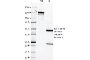 SDS-PAGE Analysis  Purified Mesothelin Mouse Monoclonal Antibody (MSLN/2131) (unconjugated). (Mesothelin 抗体  (AA 273-407) (Biotin))