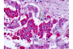 Anti-GRM7 / MGLUR7 antibody IHC of human adrenal. (GRM7 抗体  (N-Term))