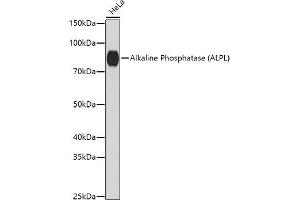Western blot analysis of extracts of HeLa cells, using Alkaline Phosphatase (ALPL) antibody (ABIN6133557, ABIN6136824, ABIN6136825 and ABIN6216013) at 1:1000 dilution. (ALPL 抗体  (AA 150-250))