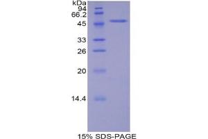 SDS-PAGE analysis of Mouse Cadherin, Heart Protein. (Cadherin 13 Protein (CDH13))