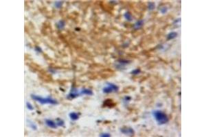 Used in DAB staining on fromalin fixed paraffin-embedded Brain tissue (Neurotrophin 3 抗体  (AA 130-255))