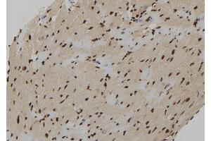 ABIN6273222 at 1/100 staining Mouse heart tissue by IHC-P. (CXXC5 抗体)