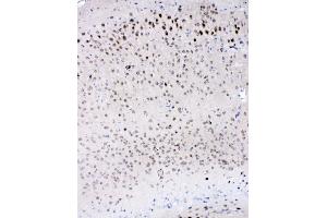 IHC analysis of IL-16 using anti-IL-16 antibody (ABIN5518927).