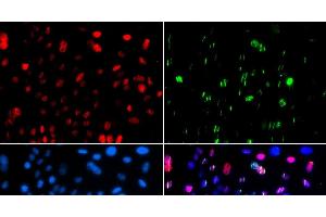 Immunofluorescence analysis of GFP-RNF168 transgenic U2OS cells using Phospho-p53(S15) Polyclonal Antibody (p53 抗体  (pSer15))