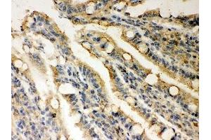 IHC-P: Rad51 antibody testing of rat intestine tissue (RAD51 抗体  (AA 1-258))