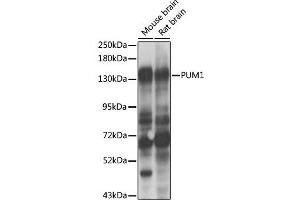 Western blot analysis of extracts of various cell lines, using PUM1 antibody (ABIN2737436) at 1:1000 dilution. (PUM1 抗体)
