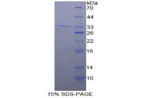 SDS-PAGE analysis of Human Adenylate Cyclase 9 Protein. (ADCY9 蛋白)