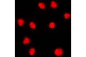 Immunofluorescent analysis of FOXC1/2 staining in THP1 cells. (FOXC1 抗体  (Center))