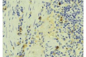 ABIN6272891 at 1/100 staining Human lymph tissue by IHC-P. (IFT57 抗体  (Internal Region))