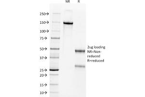 SDS-PAGE Analysis Purified Wilm's Tumor Mouse Monoclonal Antibody (WT1/857). (WT1 抗体)