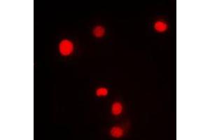 Immunofluorescent analysis of KLF11 staining in HL60 cells.