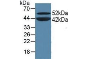 Detection of PPARa in Porcine Skeletal Muscle Tissue using Polyclonal Antibody to Peroxisome Proliferator Activated Receptor Alpha (PPARa) (PPARA 抗体  (AA 61-170))