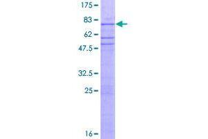 ZNF563 Protein (AA 1-476) (GST tag)