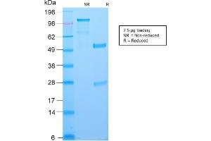SDS-PAGE Analysis Purified BCL-6 Rabbit Recombinant Monoclonal Antibody (BCL6/2497R). (Recombinant BCL6 抗体  (AA 256-389))