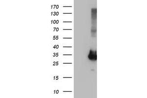 Image no. 1 for anti-Phenylethanolamine N-Methyltransferase (PNMT) antibody (ABIN1500316) (PNMT 抗体)