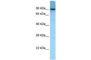 WB Suggested Anti-Aacs Antibody Titration: 1. (AACS 抗体  (Middle Region))