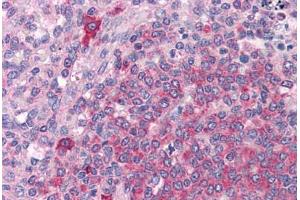 Human Spleen: Formalin-Fixed, Paraffin-Embedded (FFPE) (BTK 抗体  (AA 91-387))